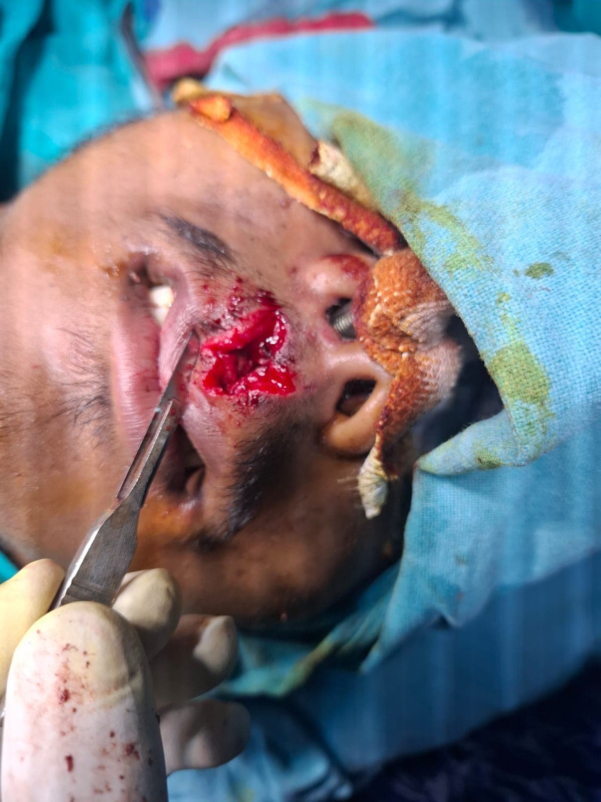 Patient Case 1