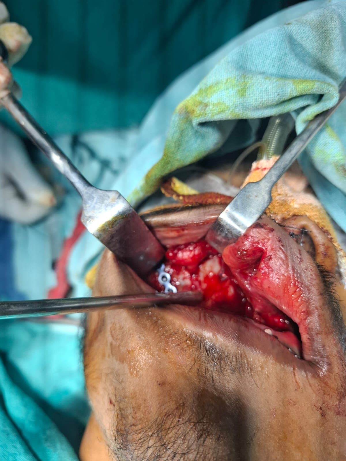 Patient Case 3