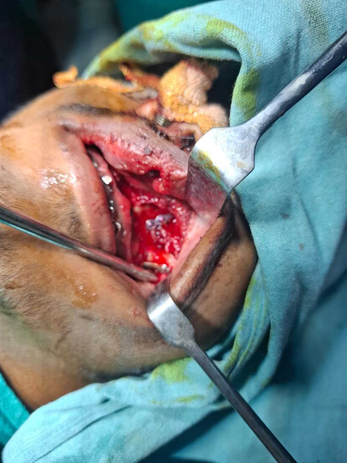 Patient Case 4