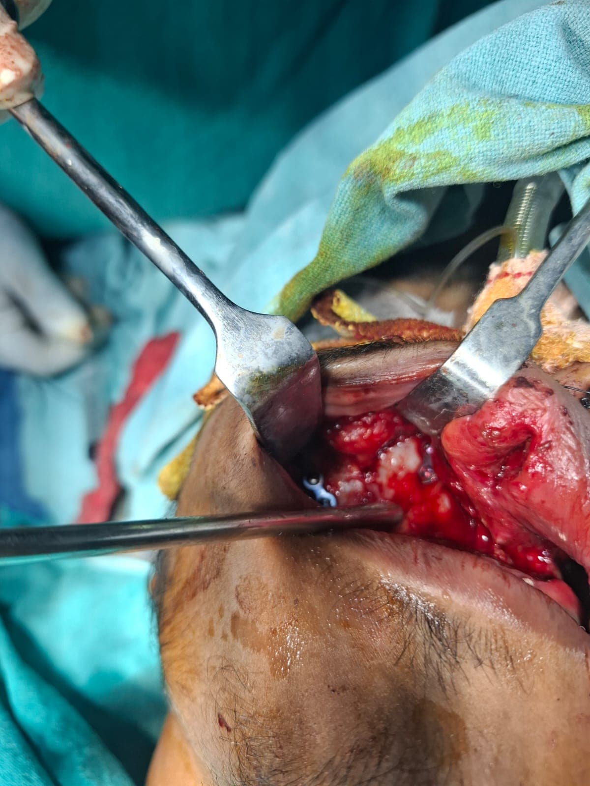 Patient Case 5