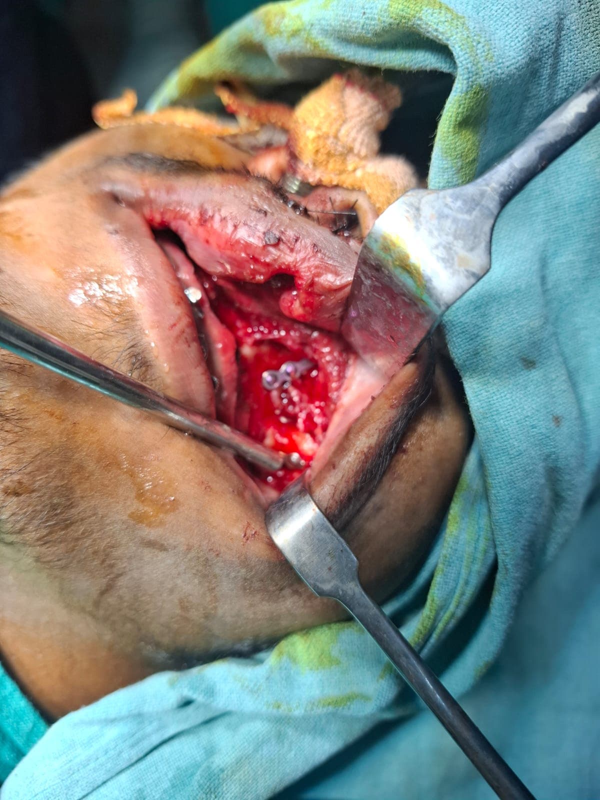 Patient Case 6